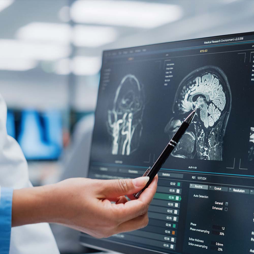 Radiologist looks at patient MRI brain scan